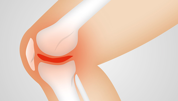 Fussballverletzungen - wenn das Knie schmerzt …